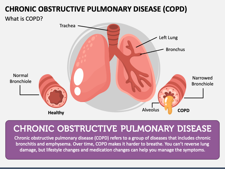 Chronic Obstructive Pulmonary Disease COPD PowerPoint Template And