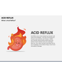 Acid Reflux PPT Slide 1