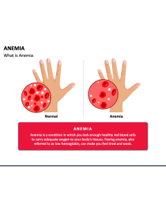 Anemia PPT Slide 1