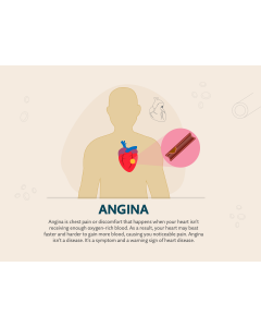 Angina PPT Slide 1