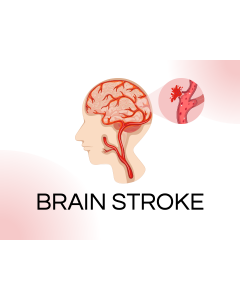 Brain Stroke PowerPoint and Google Slides Template
