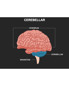 Cerebellar PPT Slide 1