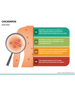 Chickenpox PowerPoint Slide 1