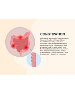 Constipation PPT Slide 1