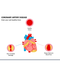 Coronary Artery Disease PPT Slide 1