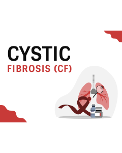 Cystic Fibrosis PPT Thumbnail