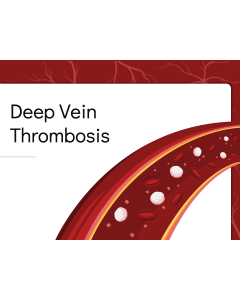 Deep Vein Thrombosis PPT Thumbnail