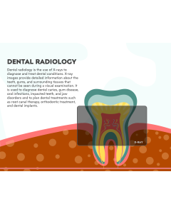 Dental Radiology PPT Slide 1