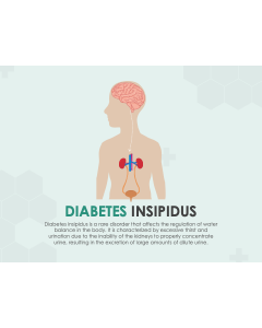 Diabetes Insipidus PPT Slide 1