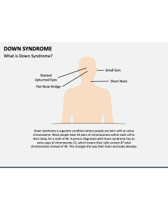 Down Syndrome PPT Slide 1