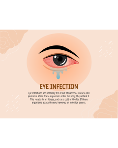 Eye Infection PPT Slide 1