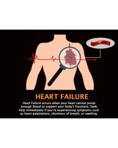 Heart Failure PPT Slide 1
