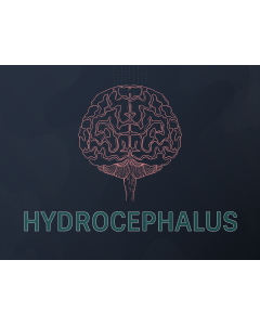 Hydrocephalus PPT Slide 1