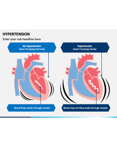 Hypertension PPT Slide 1