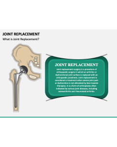 Joint Replacement PPT Slide 1