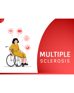 Multiple Sclerosis (MS) PPT Thumbnail