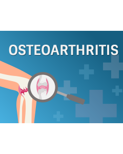 Osteoarthritis PPT Thumbnail