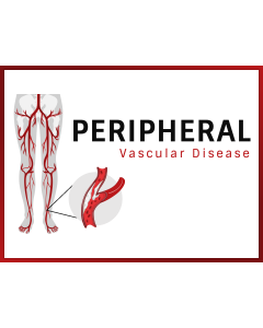 Peripheral Vascular Disease (PVD) PPT Thumbnail