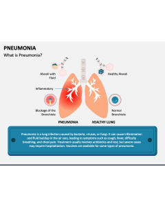 Pneumonia PPT Slide 1