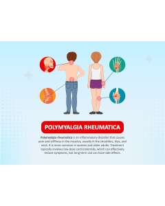 Polymyalgia Rheumatica (PMR) PPT Slide 1