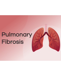 Pulmonary Fibrosis PPT Thumbnail