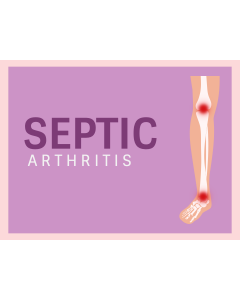 Septic Arthritis PPT Thumbnail