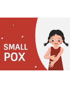 Smallpox PPT Thumbnail