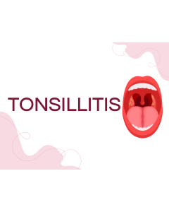 Tonsillitis PPT Thumbnail