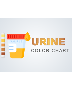Urine Color Chart PPT Slide 1