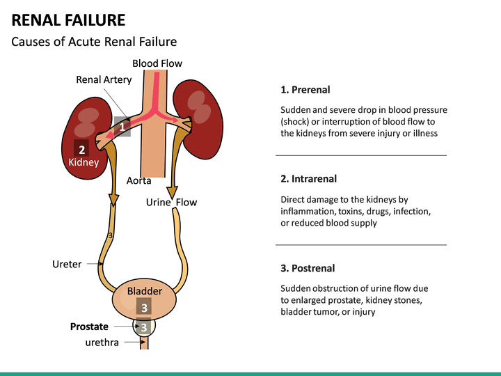 presentation of renal failure