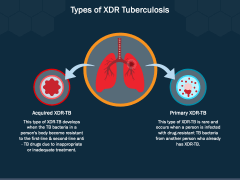 XDR Tuberculosis PowerPoint and Google Slides Template - PPT Slides