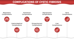 Cystic Fibrosis PPT Slide 7