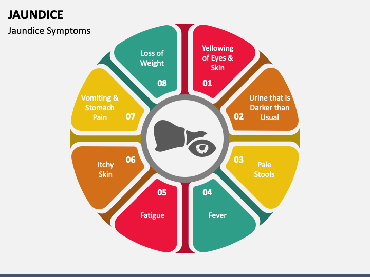 Jaundice PowerPoint and Google Slides Template - PPT Slides