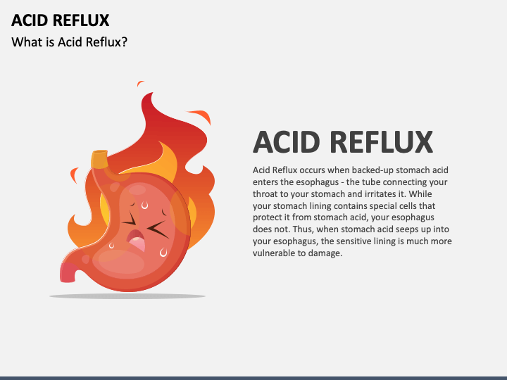 Acid Reflux PPT Slide 1