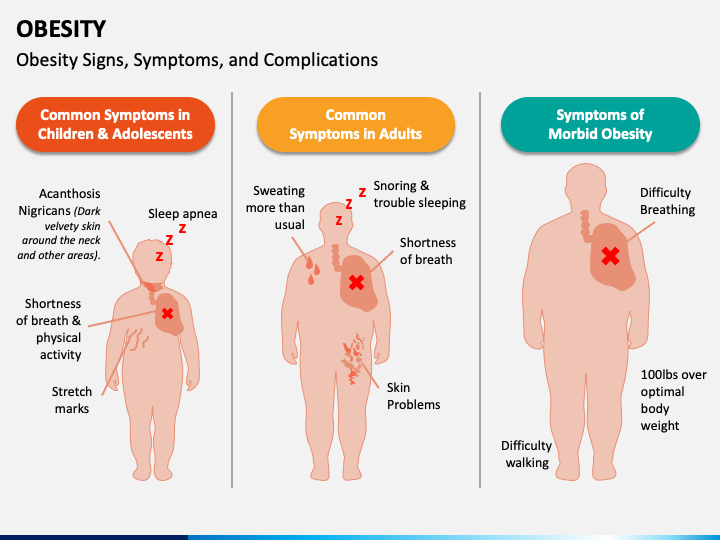 Obesity PPT Slide 1