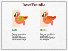 Pancreatitis PowerPoint And Google Slides Template - PPT Slides