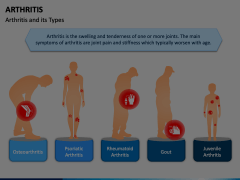 Arthritis Animated Presentation - SketchBubble