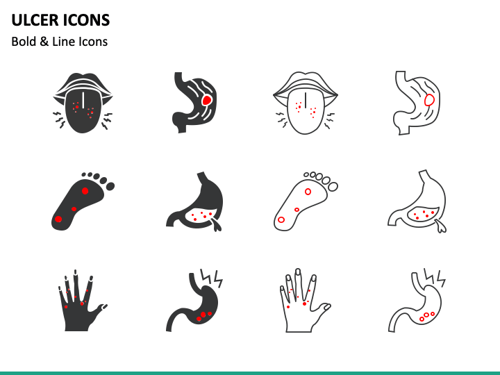 Ulcer Icons PowerPoint Slide 1