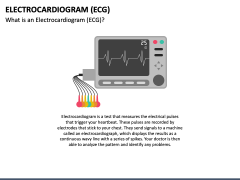 Electrocardiogram (ECG) PowerPoint and Google Slides Template - PPT Slides