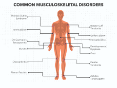 Musculoskeletal Disorders PPT Slide 3