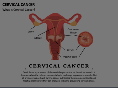 Cervical Cancer Animated Presentation - SketchBubble