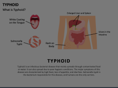 Typhoid Animated Presentation - SketchBubble
