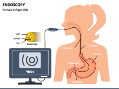 Endoscopy PPT Slide 1