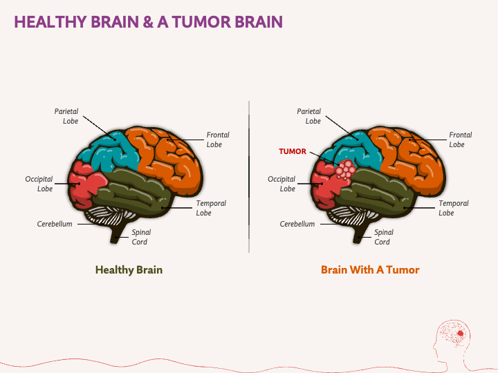Free - World Brain Tumor Day PowerPoint Template and Google Slides Theme