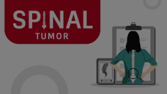 Spinal Tumor Animated Presentation - SketchBubble