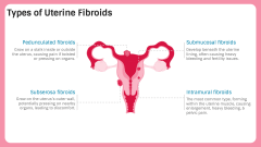 Uterine Fibroid PPT Slide 3