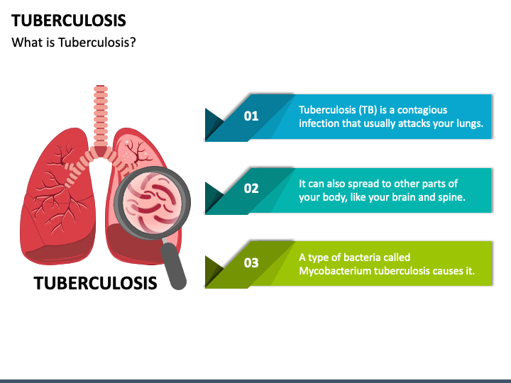 Tuberculosis PPT Slide 1