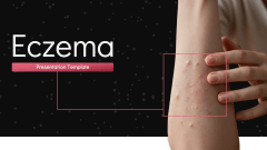 Eczema PPT Slide 1