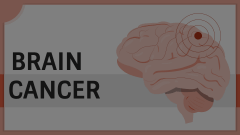Brain Cancer Animated Presentation - SketchBubble