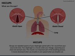 Hiccups PowerPoint Template and Google Slides Theme | SketchBubble